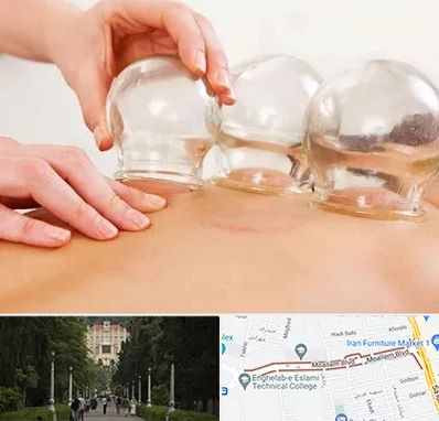 بادکش درمانی در بلوار معلم رشت