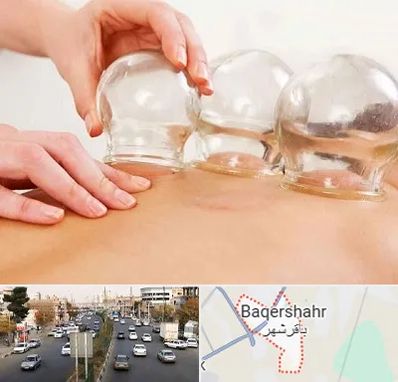 بادکش درمانی در باقرشهر