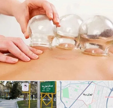 بادکش درمانی در تهران ویلا