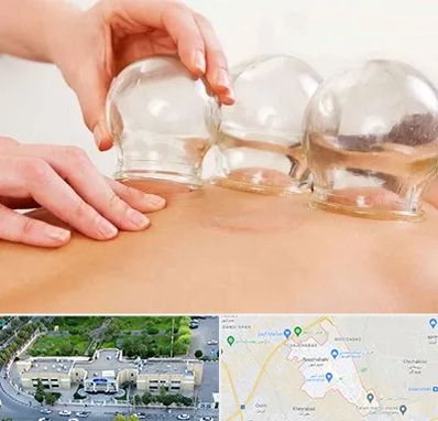 بادکش درمانی در نسیم شهر