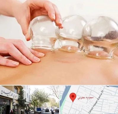 بادکش درمانی در مجیدیه جنوبی
