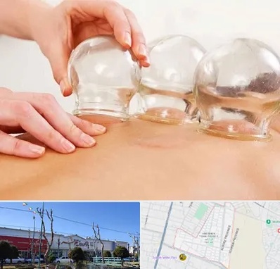 بادکش درمانی در فاز دو اندیشه