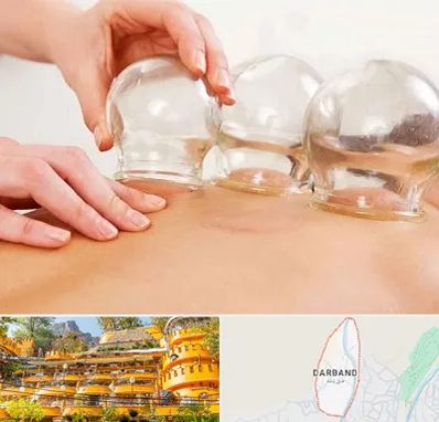 بادکش درمانی در دربند