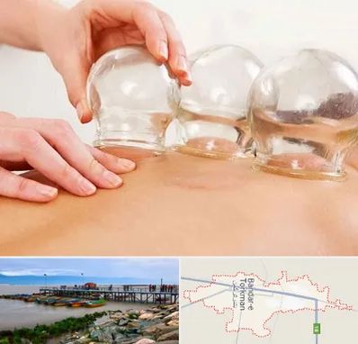بادکش درمانی در بندر ترکمن