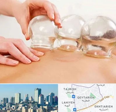 بادکش درمانی در قیطریه 