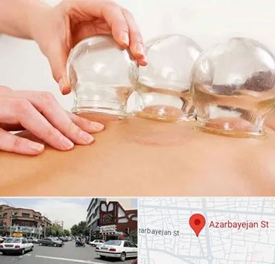 بادکش درمانی در خیابان آذربایجان