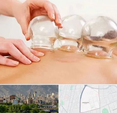 بادکش درمانی در جمشیدیه