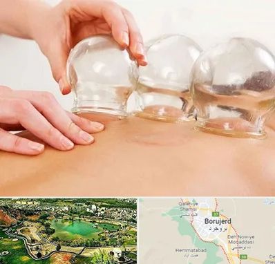 بادکش درمانی در بروجرد