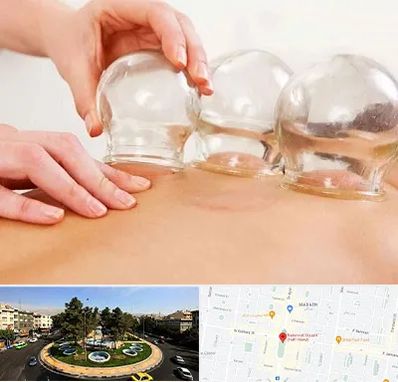 بادکش درمانی در هفت حوض