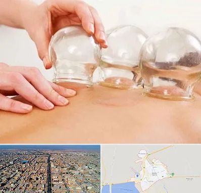 بادکش درمانی در بندر ماهشهر