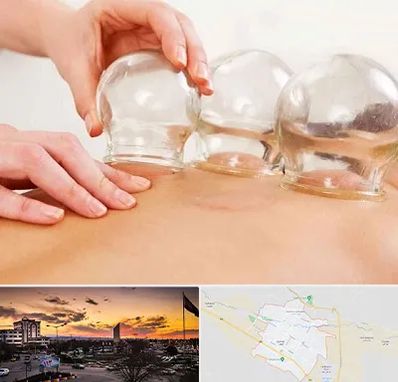 بادکش درمانی در قوچان