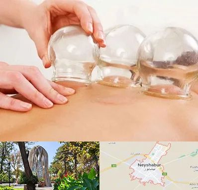 بادکش درمانی در نیشابور