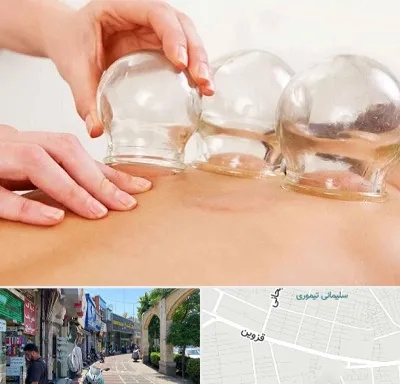 بادکش درمانی در خیابان قزوین