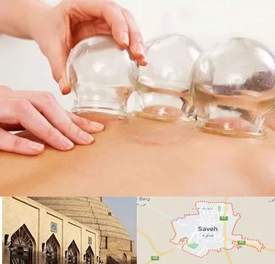 بادکش درمانی در ساوه