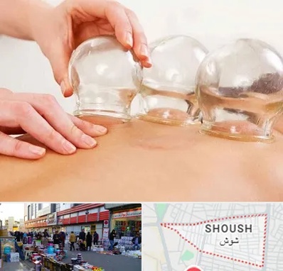 بادکش درمانی در شوش