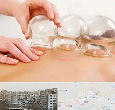 بادکش درمانی در محمد شهر کرج