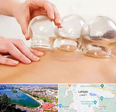 بادکش درمانی در لاهیجان