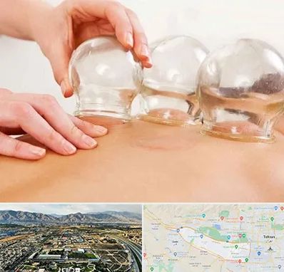 بادکش درمانی در منطقه 21 تهران