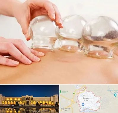 بادکش درمانی در برازجان