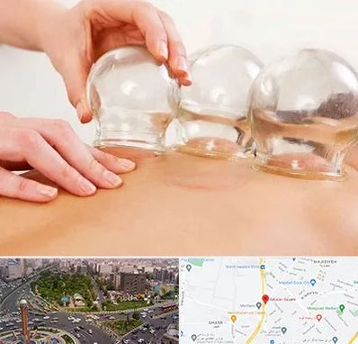 بادکش درمانی در سبلان