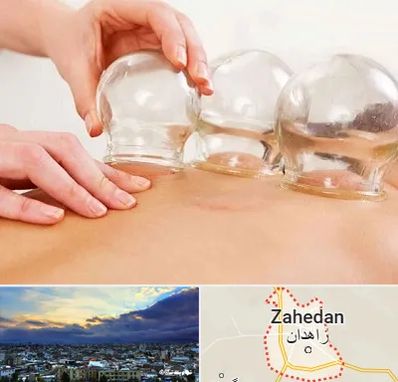 بادکش درمانی در زاهدان