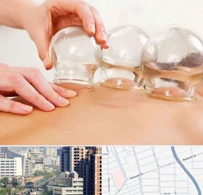 بادکش درمانی در خیابان بهشتی