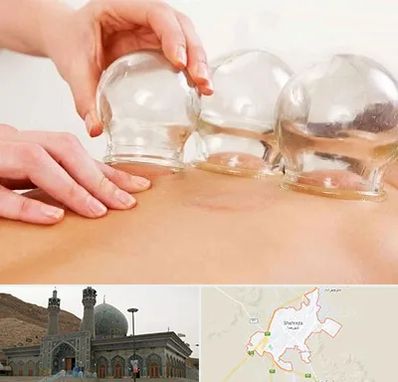 بادکش درمانی در شهرضا