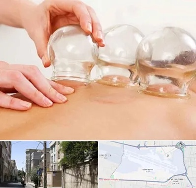 بادکش درمانی در مهرآباد