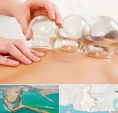 بادکش درمانی در سیستان و بلوچستان