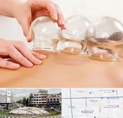 بادکش درمانی در مرکز تهران