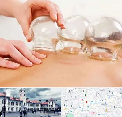 بادکش درمانی در میدان شهرداری رشت