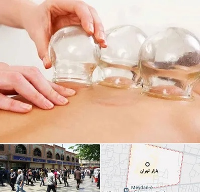 بادکش درمانی در بازار تهران