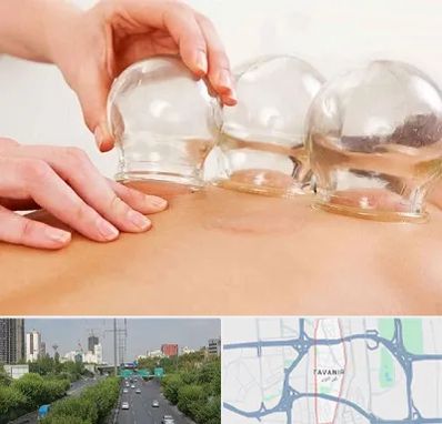 بادکش درمانی در توانیر