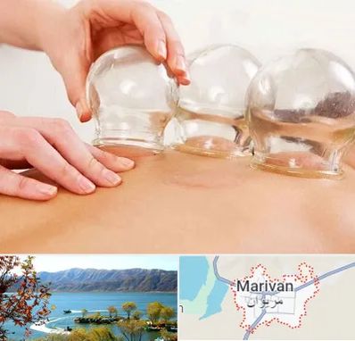 بادکش درمانی در مریوان