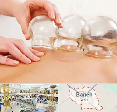 بادکش درمانی در بانه