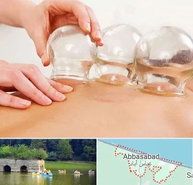 بادکش درمانی در عباس آباد
