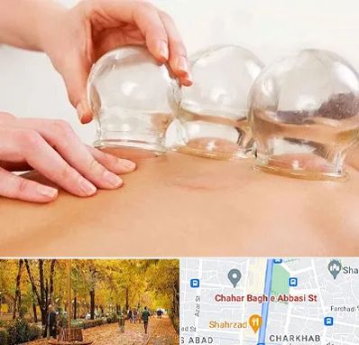 بادکش درمانی در چهارباغ اصفهان