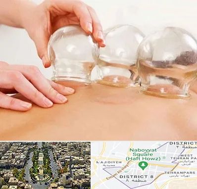 بادکش درمانی در نارمک 