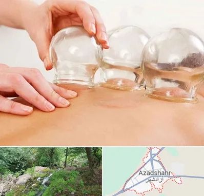 بادکش درمانی در آزادشهر