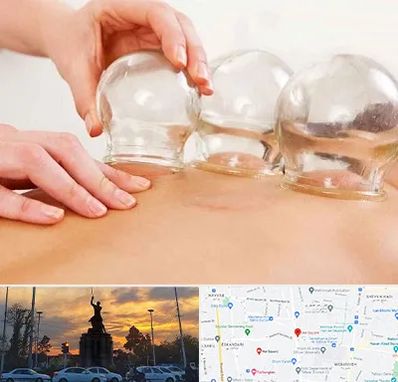 بادکش درمانی در میدان حر