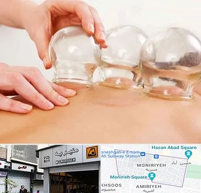 بادکش درمانی در منیریه 