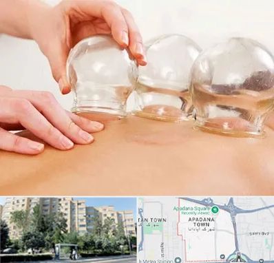 بادکش درمانی در آپادانا