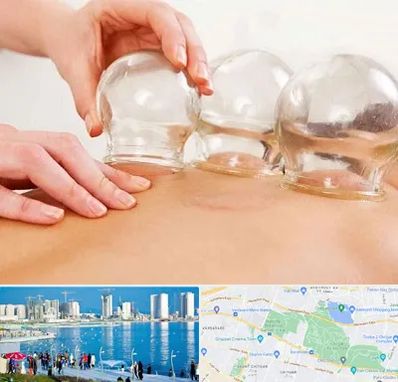 بادکش درمانی در چیتگر 