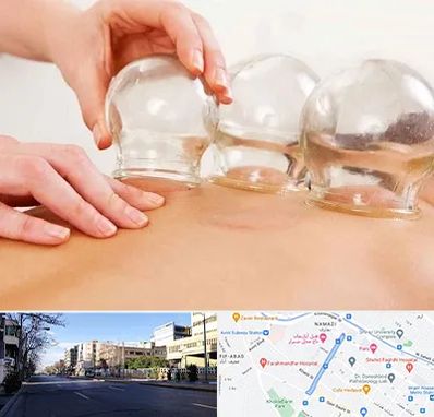 بادکش درمانی در خیابان ملاصدرا شیراز