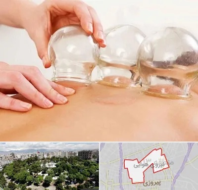 بادکش درمانی در نیروی هوایی