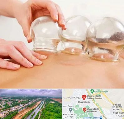 بادکش درمانی در قصرالدشت شیراز