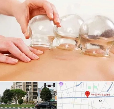 بادکش درمانی در میدان فردوسی تهران