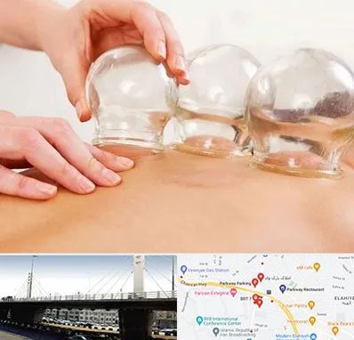 بادکش درمانی در پارک وی 