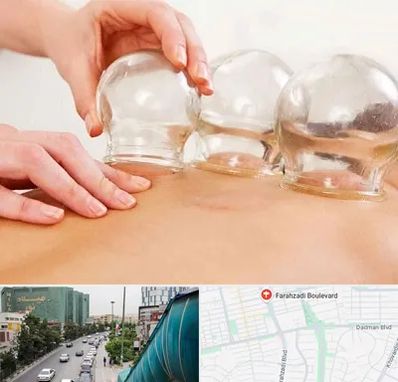 بادکش درمانی در بلوار فرحزادی