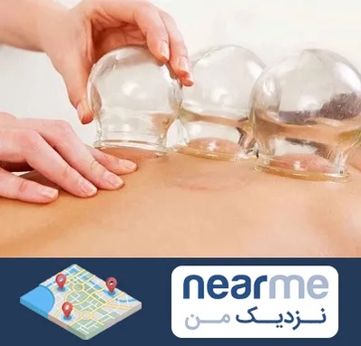 بادکش درمانی در نزدیک من